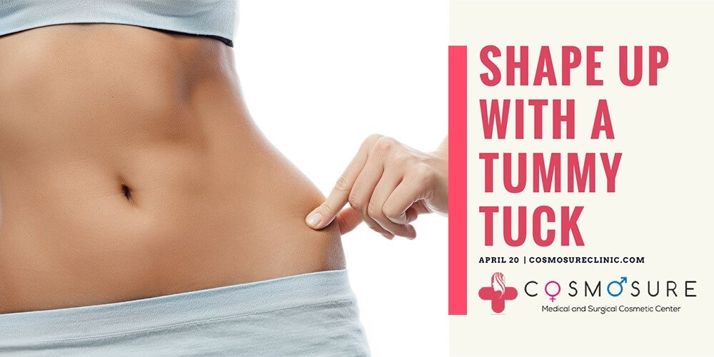 Shape up with a tummy tuck