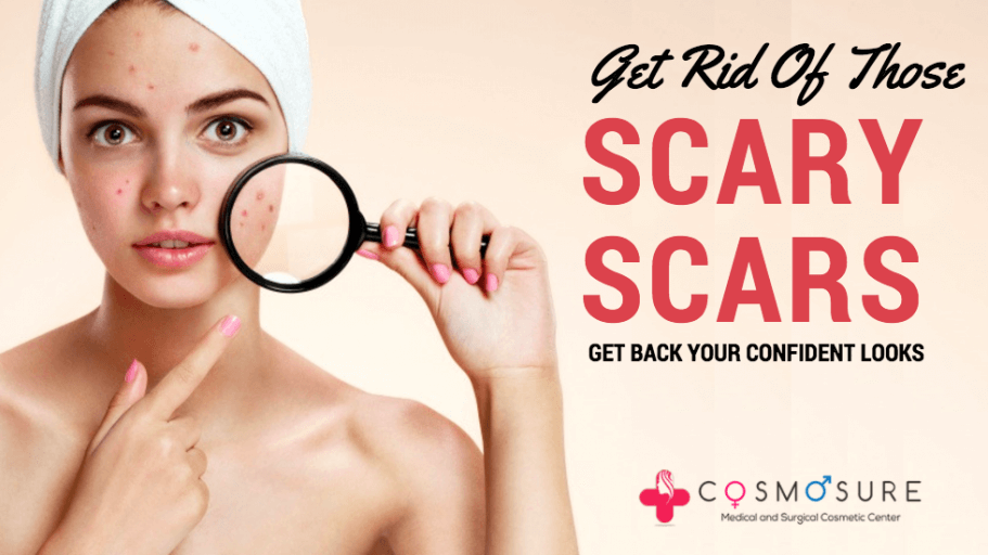 Rid Of Those Scary Scars