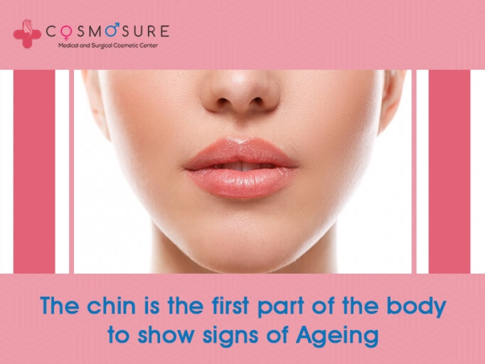 Signs of Ageing