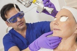 Laser Treatment for Pimples in Hyderabad