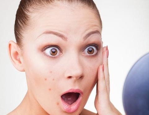 Prevent Pimples