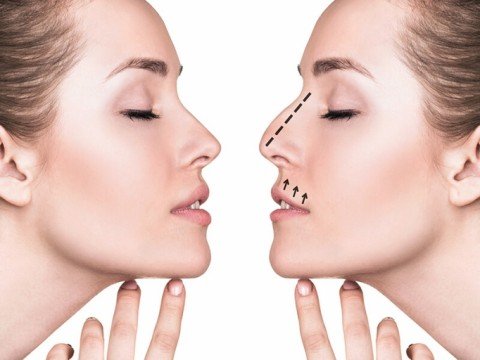 Nose Job