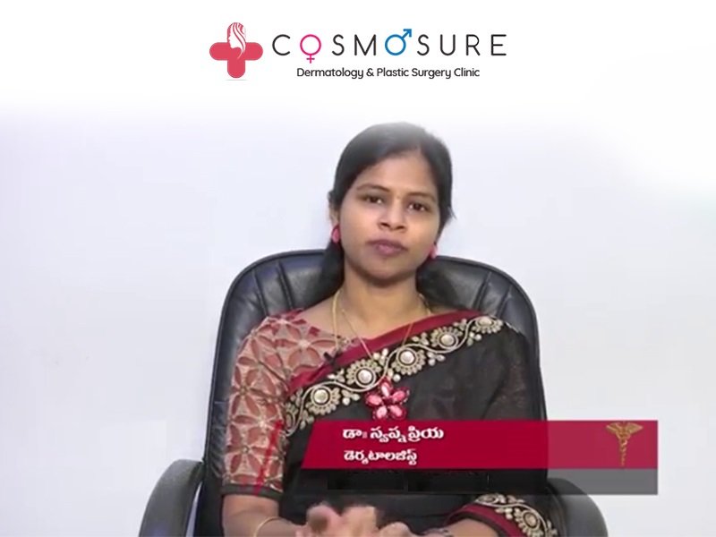 Hair Loss and Baldness Solution for Men and Women by Dr Swapna priya, one of the best skin specialist in hyderabad