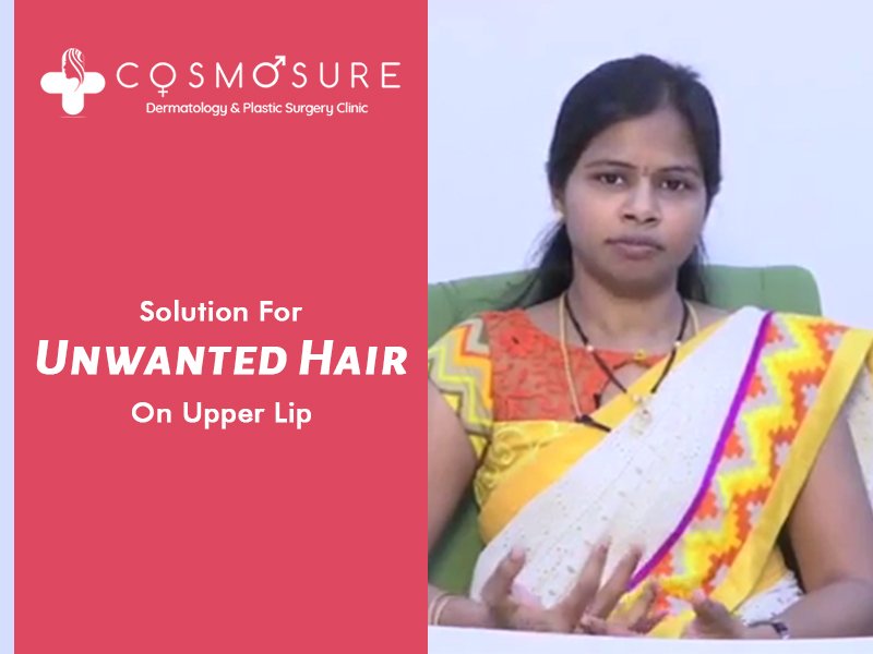 permanent upper lip hair removal by Dr Swapna Priya, one of the best Skin specialist in hyderabad