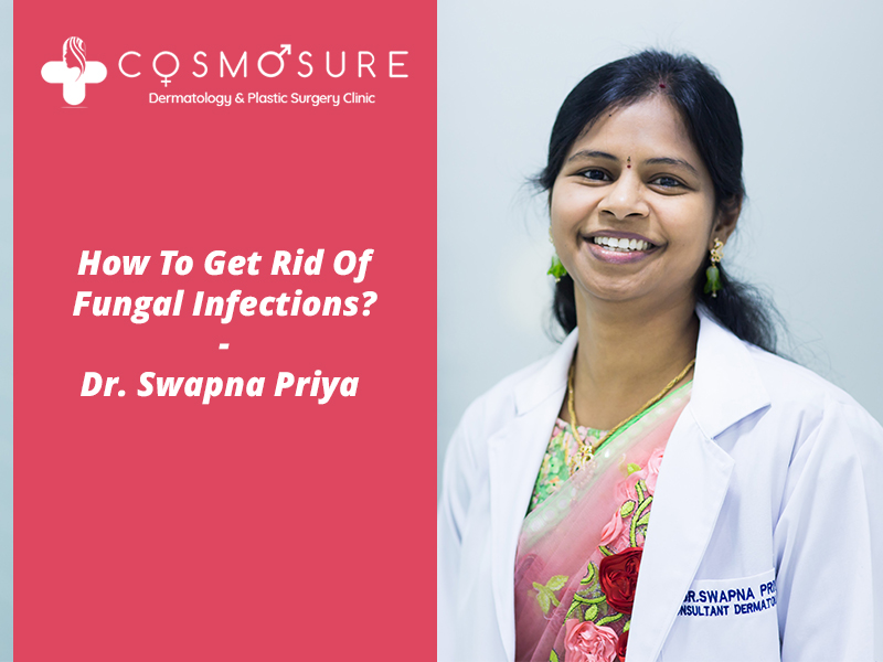 Best skin fungal infection treatment by Dr Swapna Priya, One of the best skin specialist in Hyderabad