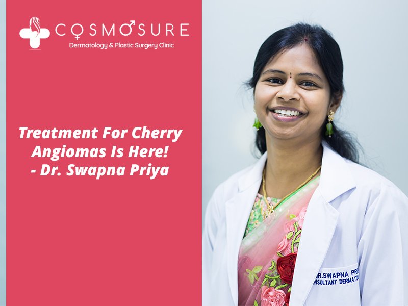 Best Treatment For Cherry Angiomas by Dr Swapna Priya, One of the best skin doctor in Hyderabad