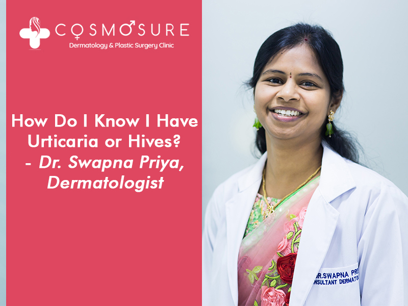 All types doubts about skin problems and Urticaria cleared by Dr Swapna priya, best Dermatology doctor in Hyderabad